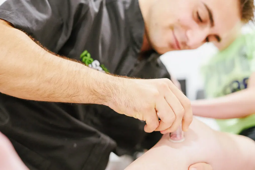 ventosas curso - Cómo se le llama a la terapia con ventosas