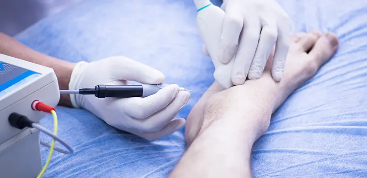 curso epi - Cuántas sesiones de EPI son necesarias