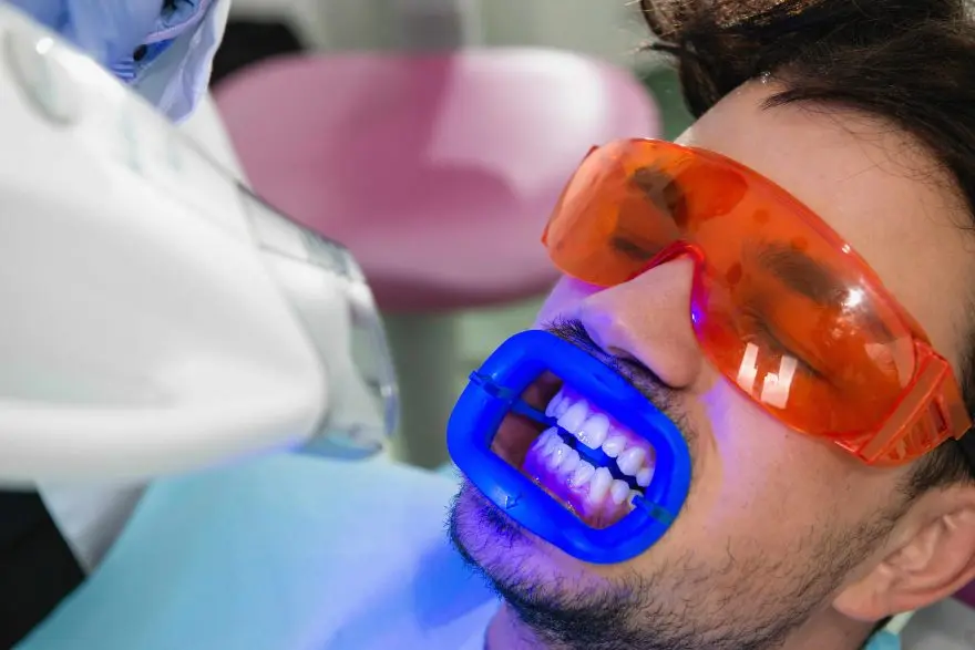 curso de blanqueamiento dental - Cuánto cuesta un blanqueamiento dental en los Estados Unidos