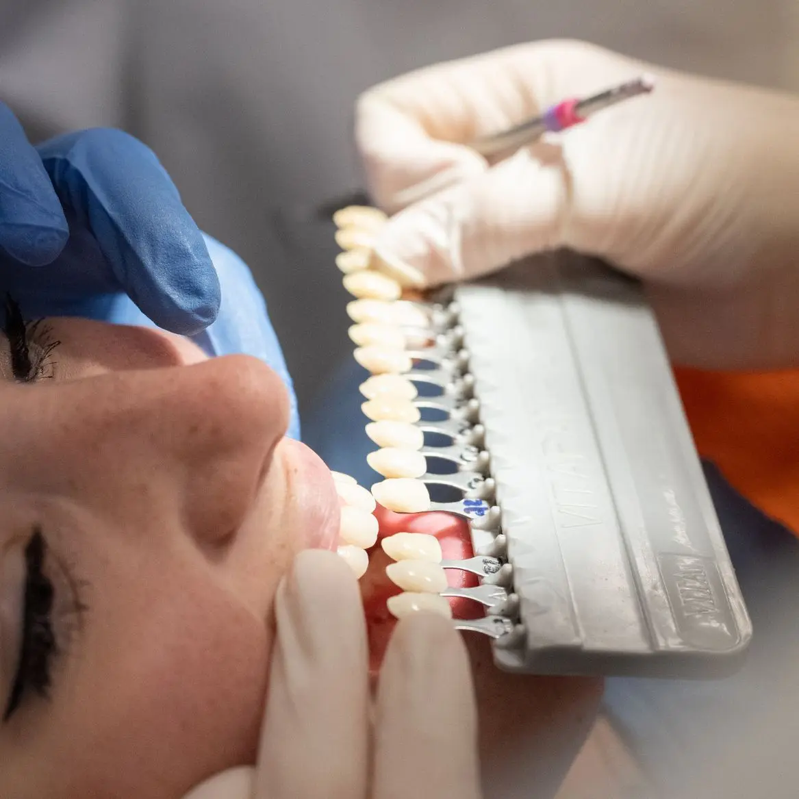 curso higiniesta dental barcelona - Cuánto gana un higienista dental en Barcelona