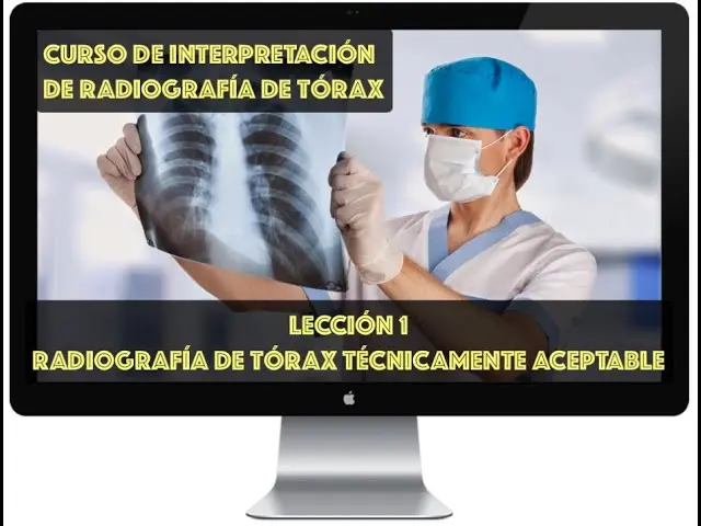 curso de radiografia - Cuánto tiempo hay que estudiar para ser radiólogo
