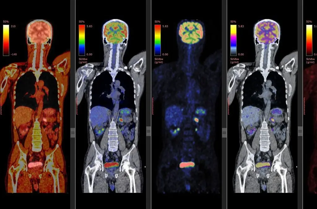 Curso de Medicina Nuclear: Guía Completa - Cuántos años dura la carrera de medicina nuclear curso de medicina nuclear - Cuántos años dura la carrera de medicina nuclear