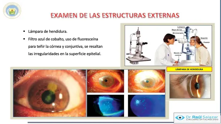 curso de oculista - Cuántos años hay que estudiar para ser oculista