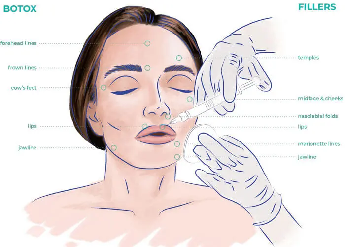 curso de botox para medicos - Qué carrera estudian los que ponen bótox