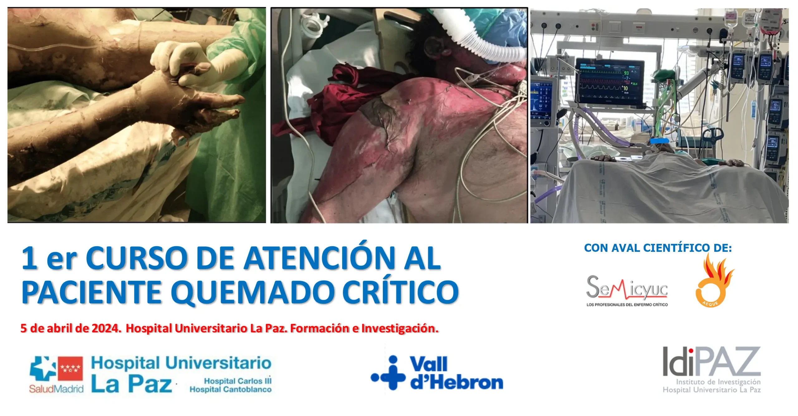 hospital del quemado cursos - Qué especialidad ve a los quemados