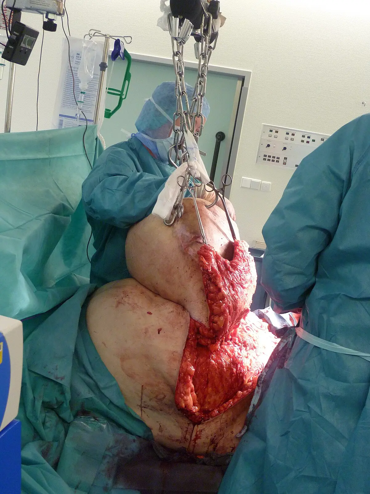 curso de obesidad - Qué rama estudia la obesidad