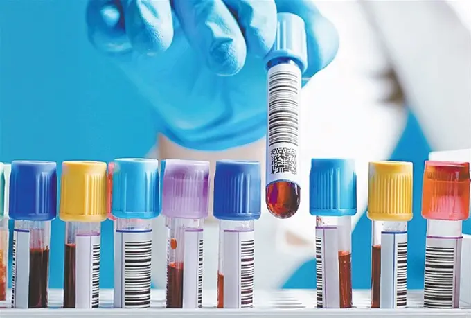 cursos de laboratorio clinico online gratis - Qué se aprende en un curso de Laboratorio Clínico