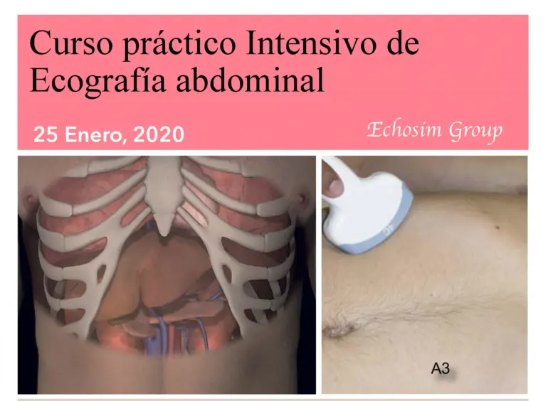 Curso de Ecografía Abdominal: Guía Completa - Qué se necesita para hacer una ecografía abdominal curso de ecografia abdominal - Qué se necesita para hacer una ecografía abdominal